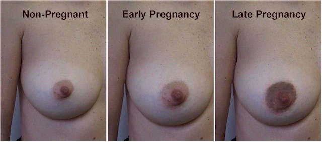 Breast pregnancy